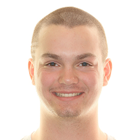 Orthodontic smile transformation before and after