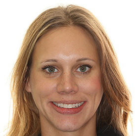 Orthodontic smile transformation before and after