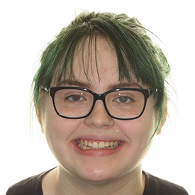 Orthodontic smile transformation before and after